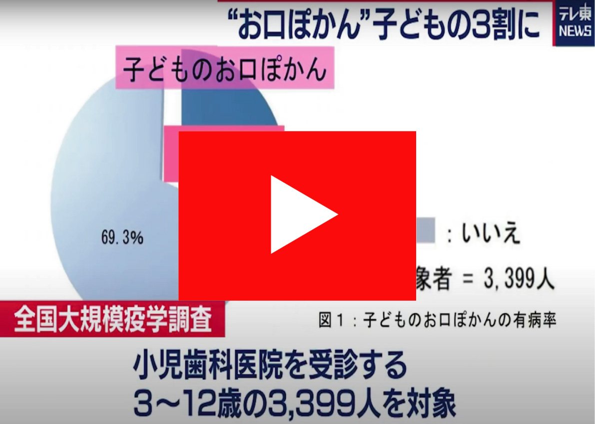 お口ポカン 開口 は 自然治癒が難しい現代の新たな疾病です 調布市の歯医者ならあきら歯科 柴崎駅改札正面